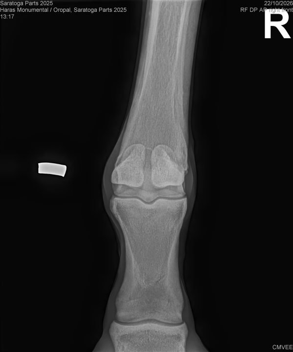 Radiografía del lote 125